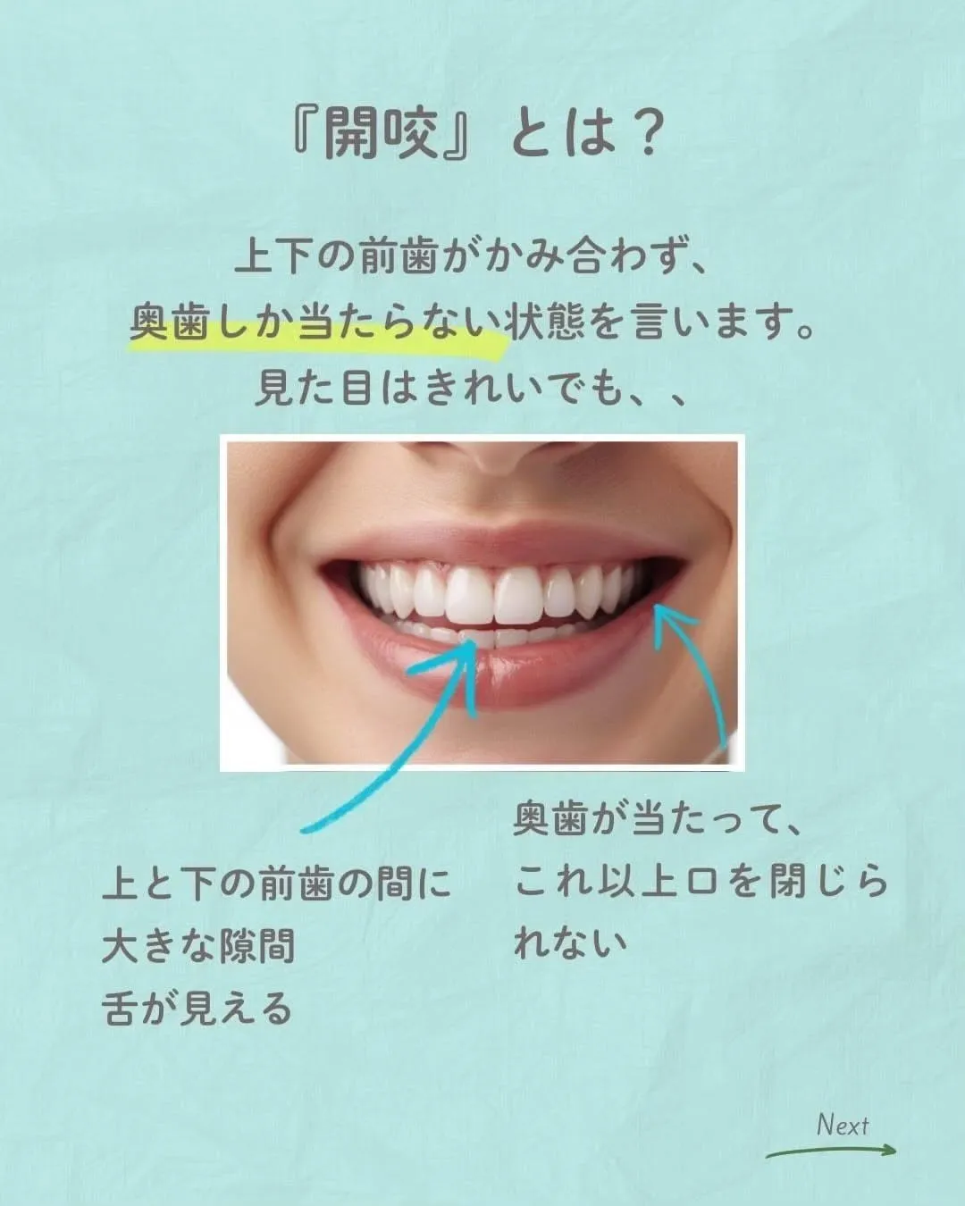 天神橋筋六丁目|歯列矯正専門