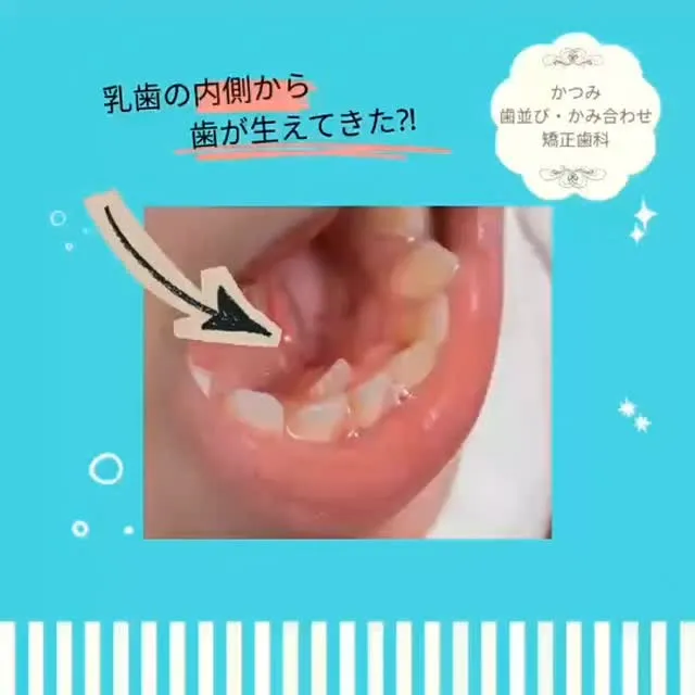 天神橋筋六丁目|歯列矯正専門