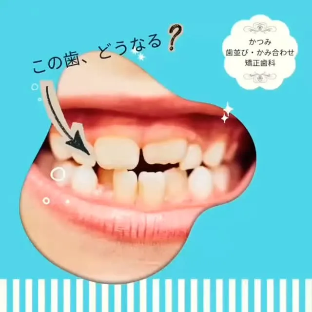 天神橋筋六丁目|歯列矯正専門